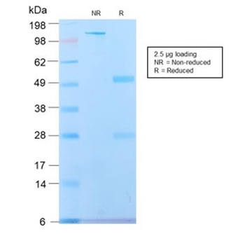 SPTBN2 Antibody / Spectrin beta III