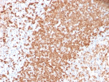 TCL1 Antibody