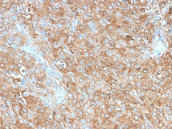CD63 Antibody / LAMP-3