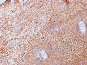 CD40 Ligand Antibody / TRAP / CD154