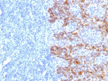 Acidic Cytokeratin Antibody