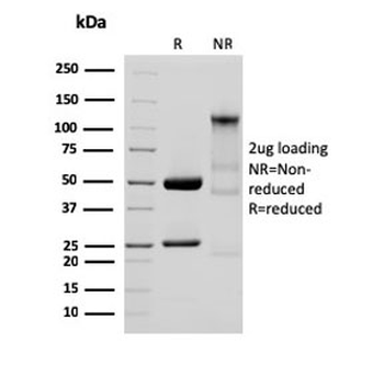 Glycoprotein 2 Antibody / GP2 / ZAP75