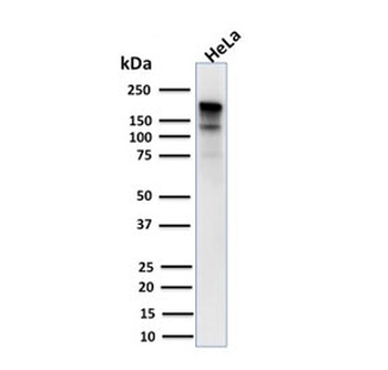 MSH6 Antibody