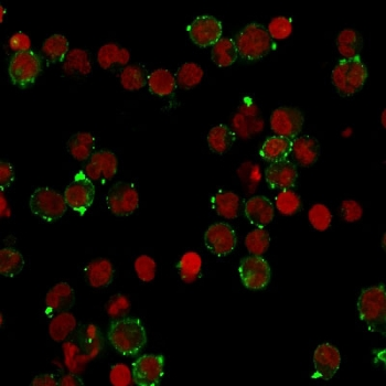 HLA-DQ Antibody (MHC II)