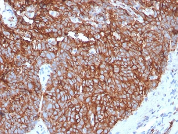 GLUT1 Antibody / SLC2A1