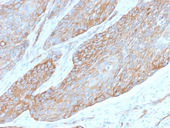 SPTBN2 Antibody / Spectrin beta III