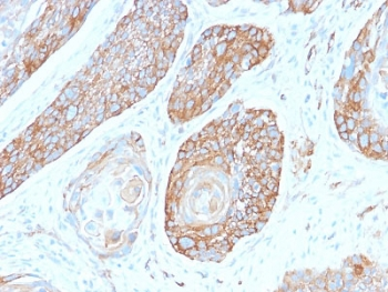 SPTBN2 Antibody / Spectrin beta III