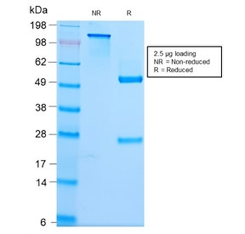 SPTBN2 Antibody / Spectrin beta III