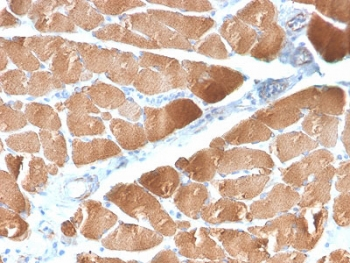 Desmin Antibody (Muscle cell marker)