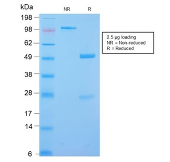 Desmin Antibody (Muscle cell marker)