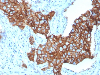 HER2 Antibody / ErbB2