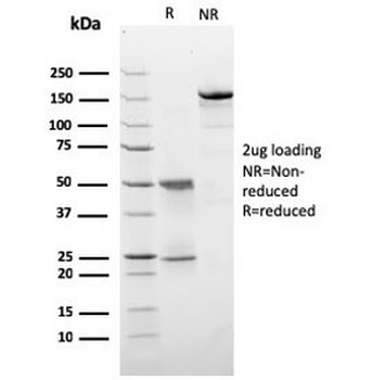 HER2 Antibody / ErbB2