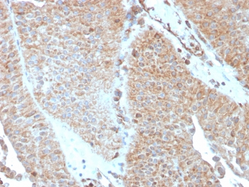 SERBP1 Antibody / PAI-RBP1