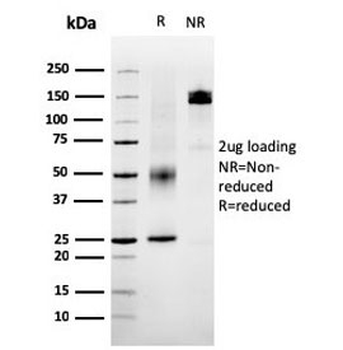 SERBP1 Antibody / PAI-RBP1