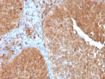 SERBP1 Antibody / PAI-RBP1