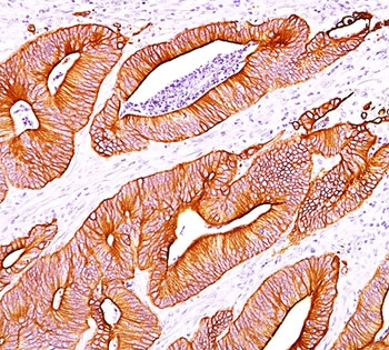 Pan Cytokeratin Antibody Cocktail