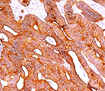 Pan Cytokeratin Antibody Cocktail