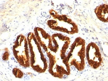 Cytokeratin 18 Antibody Cocktail