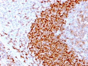 CD79b Antibody