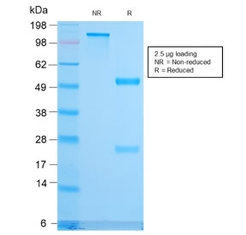 CD79b Antibody