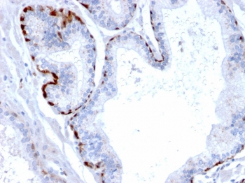 Cystatin A Antibody / CSTA