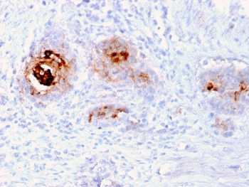 TAG-72 Antibody
