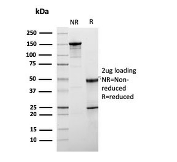 HER2 Antibody / ErbB2