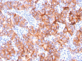 HER2 Antibody / ErbB2