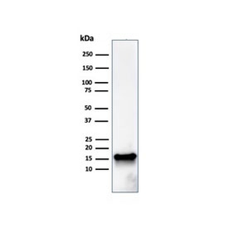 FABP5 Antibody