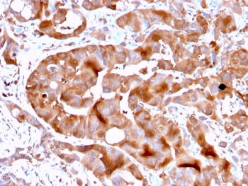 FABP5 Antibody