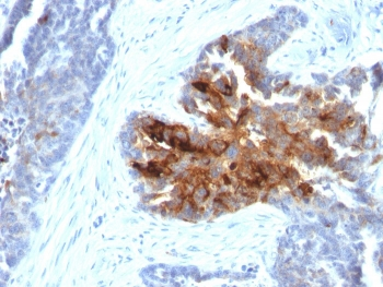 TAG-72 Antibody