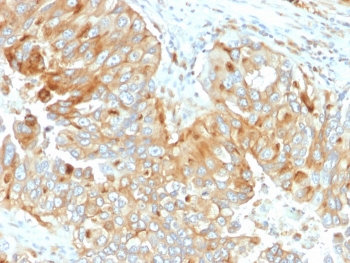 HLA-DRB1 Antibody