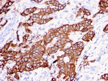 HER2 Antibody / ErbB2