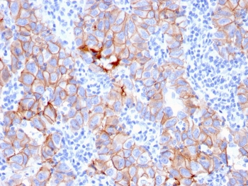 HER2 Antibody / ErbB2