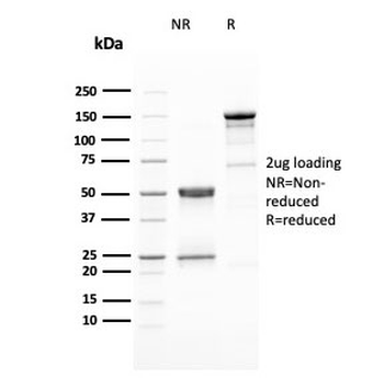 HER2 Antibody / ErbB2
