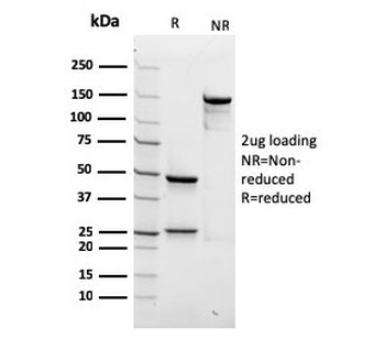 SPTBN2 Antibody / Spectrin beta III