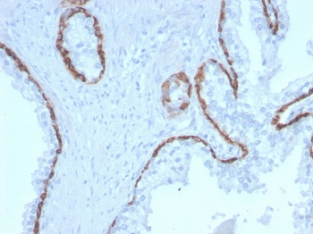 Keratin 15 Antibody / Cytokeratin 15