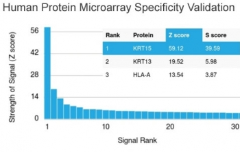 Keratin 15 Antibody / Cytokeratin 15