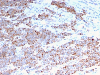 Cytokeratin 18 Antibody