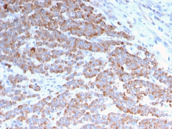 Cytokeratin 18 Antibody