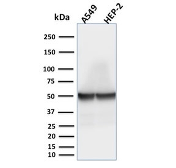 Cytokeratin 18 Antibody