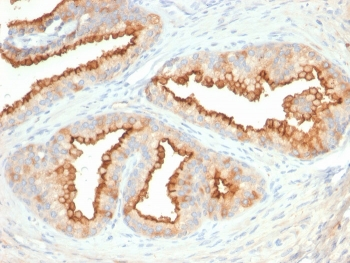CD10 Antibody