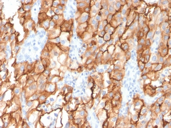 CD10 Antibody