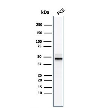 Ornithine Decarboxylase Antibody / ODC1