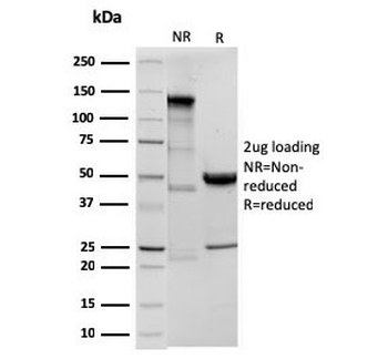 Ornithine Decarboxylase Antibody / ODC1