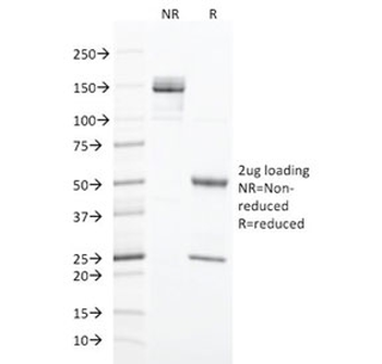 Cytokeratin 20 Antibody / CK20