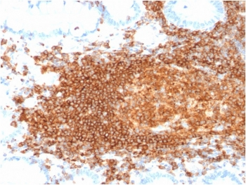 CD45RB Antibody (B-cell marker)
