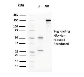 C1QA Antibody / Complement C1q A-Chain
