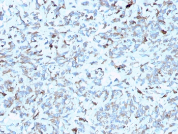 C1QA Antibody / Complement C1q A-Chain