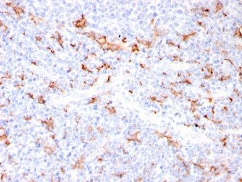 S100A9 + Calprotectin Antibody